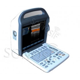 Ultratunog scanner