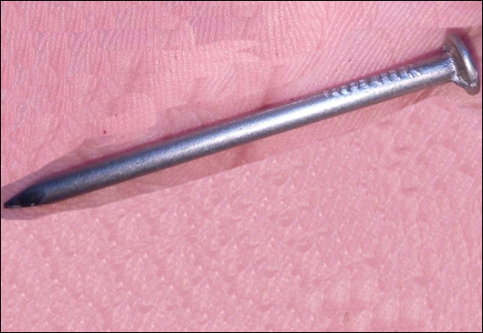 Common Nails